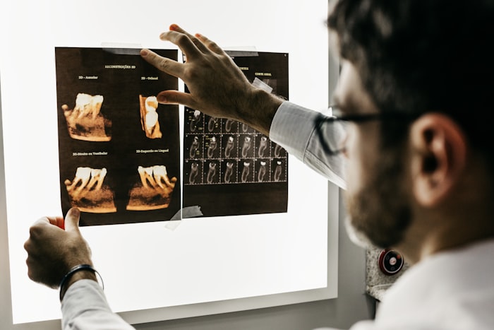 Doktor pregledava snimke