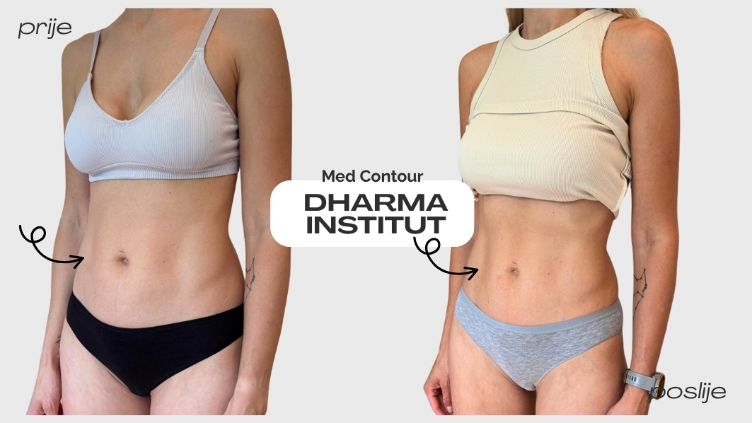 med contour