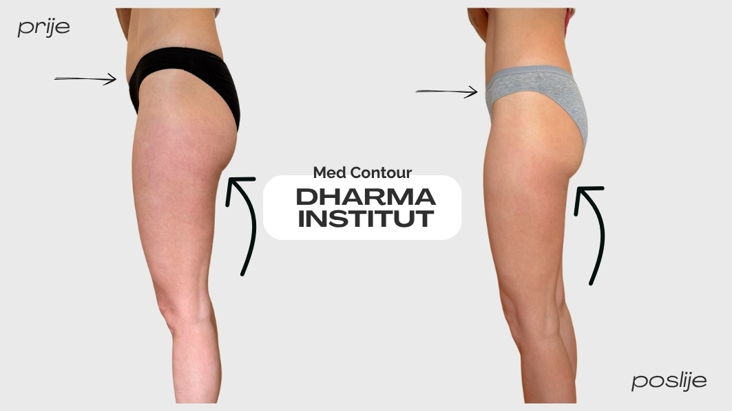 med contour