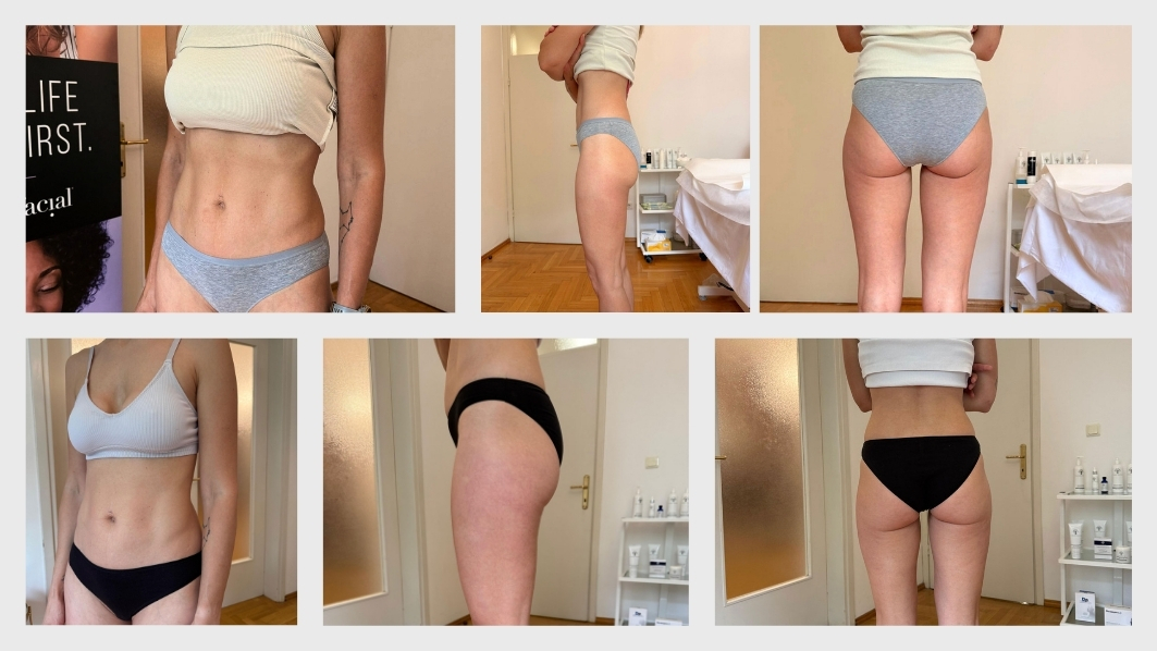 med contour