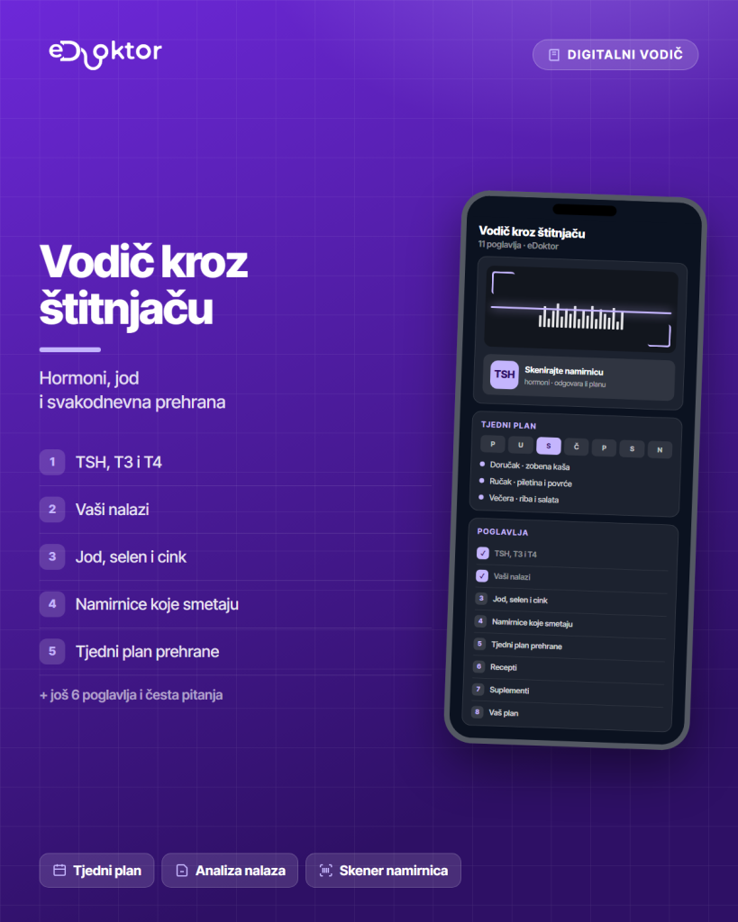 Vodic kroz stitnjacu