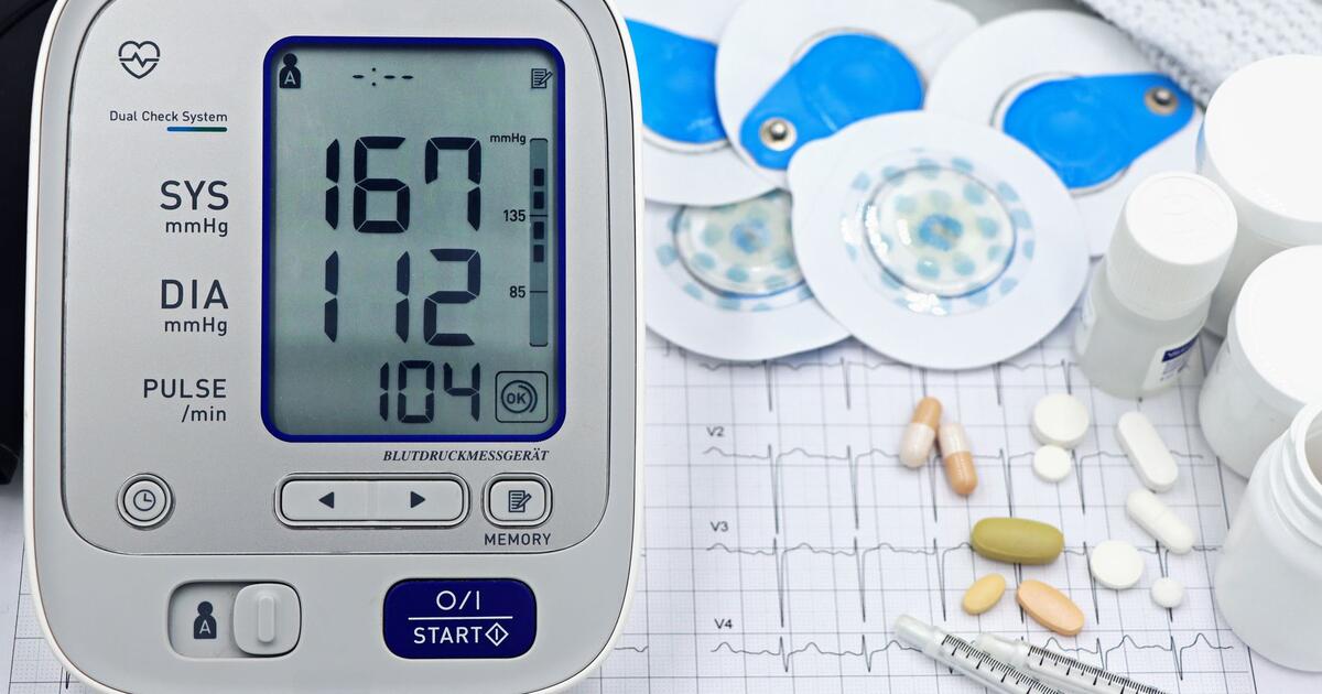 Kateter u koronarnoj arteriji tijekom angioplastike