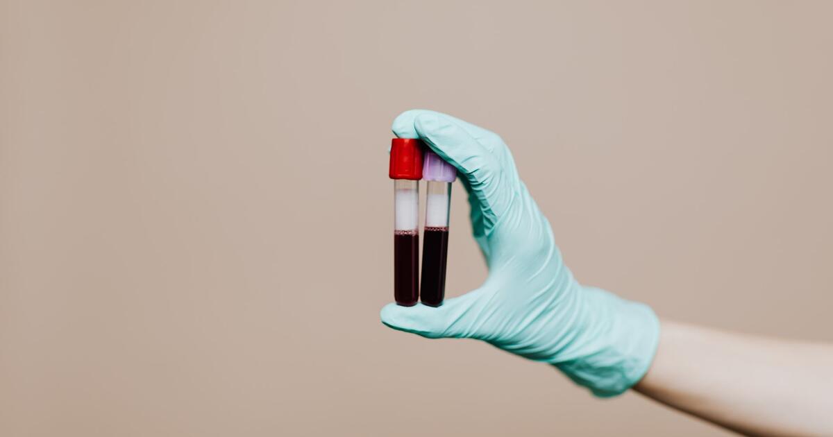 epruvete za vadenje krvi u laboratoriju