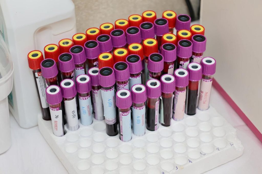 laboratory blood test tubes for liver function panel, clinical setting, no people