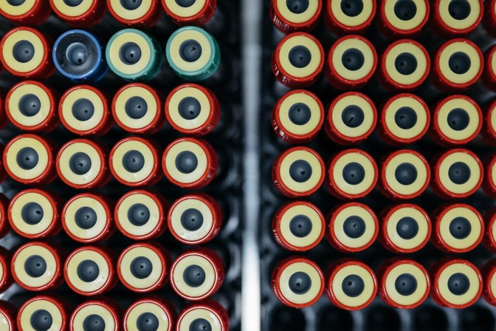 close-up of blood sample tubes in a hospital laboratory rack