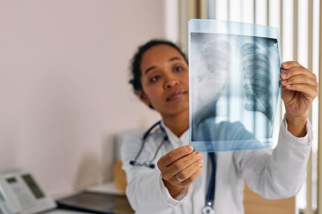 scientist examining lung x-ray in laboratory