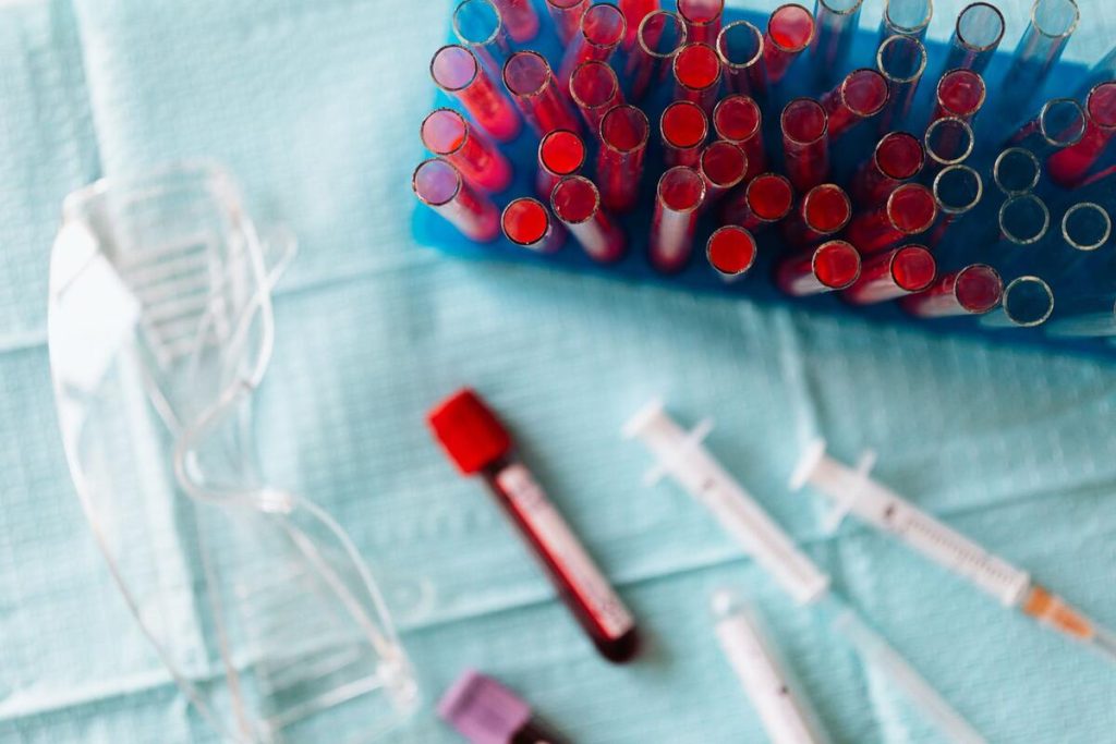 laboratory blood test tubes on a tray in a clinical setting