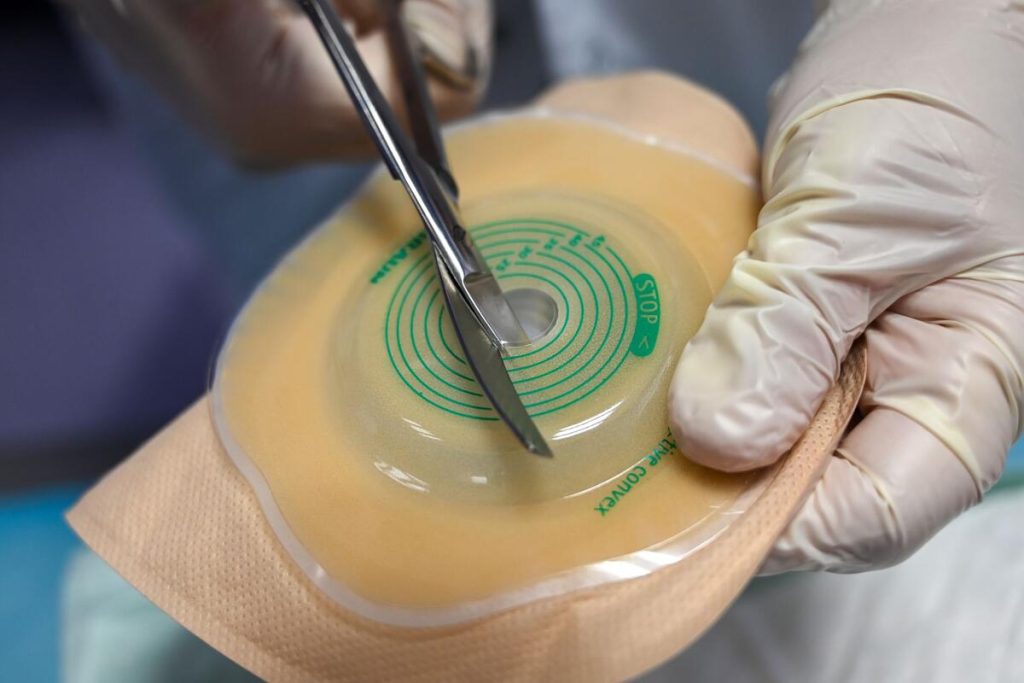 colostomy ileostomy care kit and skin barrier wipes on a clean table, no people