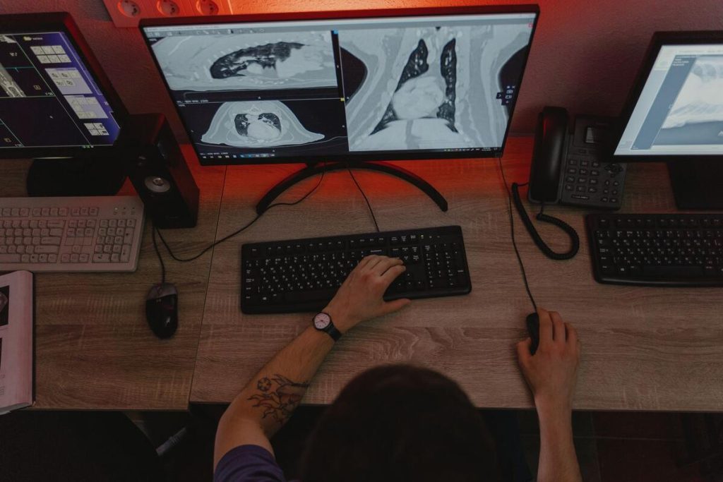 oncology researcher examining pancreatic cancer cell scans on monitor, no faces visible