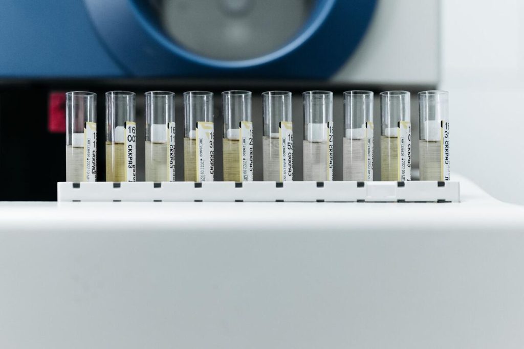 medical laboratory test tubes research africa