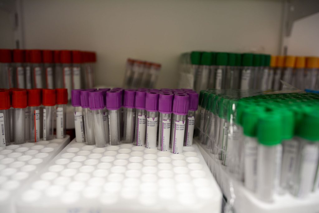blood sample test tubes in a medical laboratory, scientific research, no people